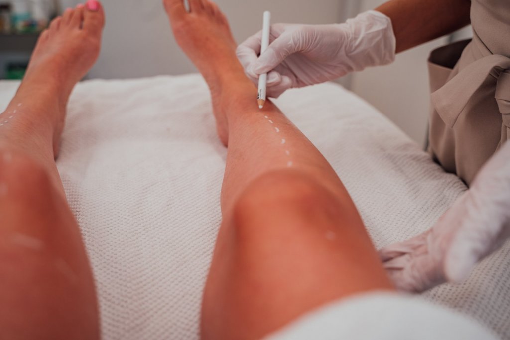 Geheimtipp Muenchen Skinlabs Laser Haarentfernung 17 – ©Geheimtipp München