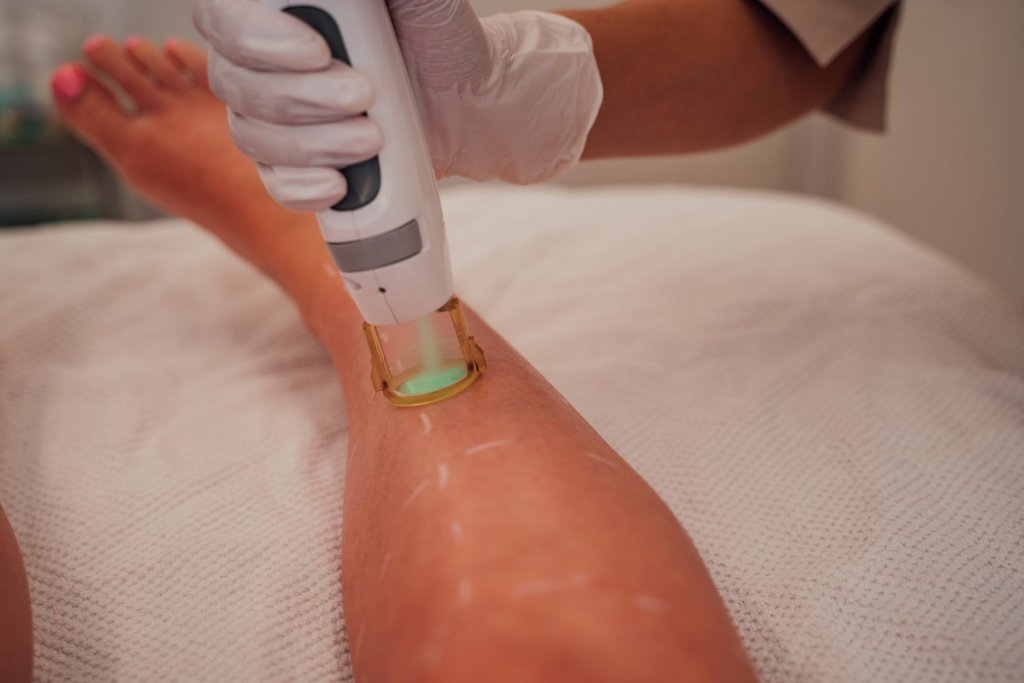 Geheimtipp Muenchen Skinlabs Laser Haarentfernung 24 – ©Geheimtipp München